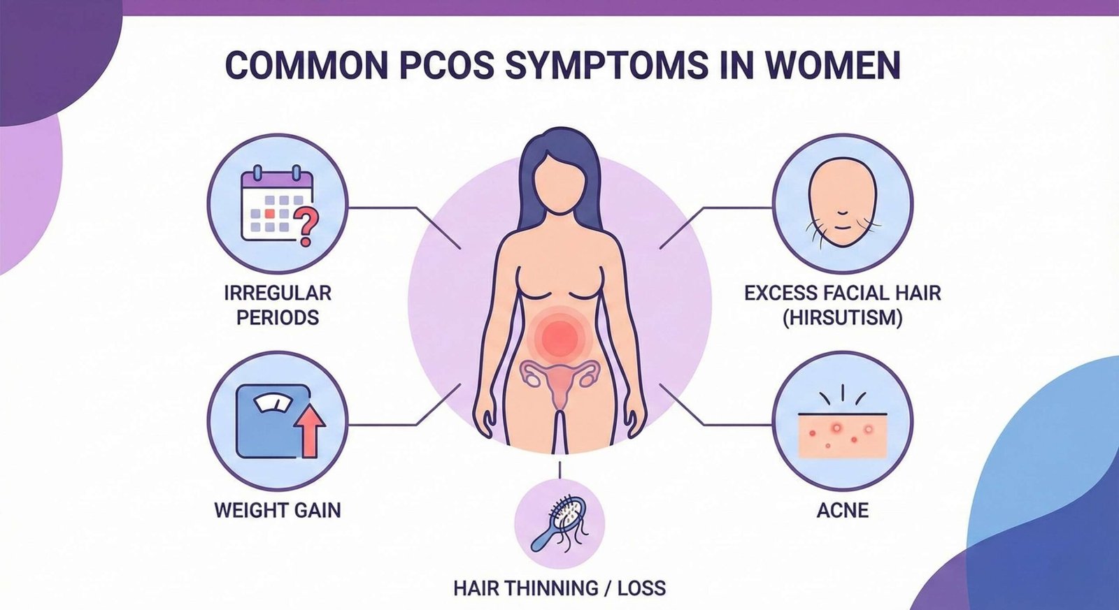 Infographic showing common PCOS symptoms in women like irregular periods and weight gain