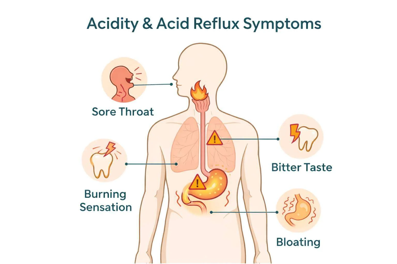 Acidity and reflux symptoms
