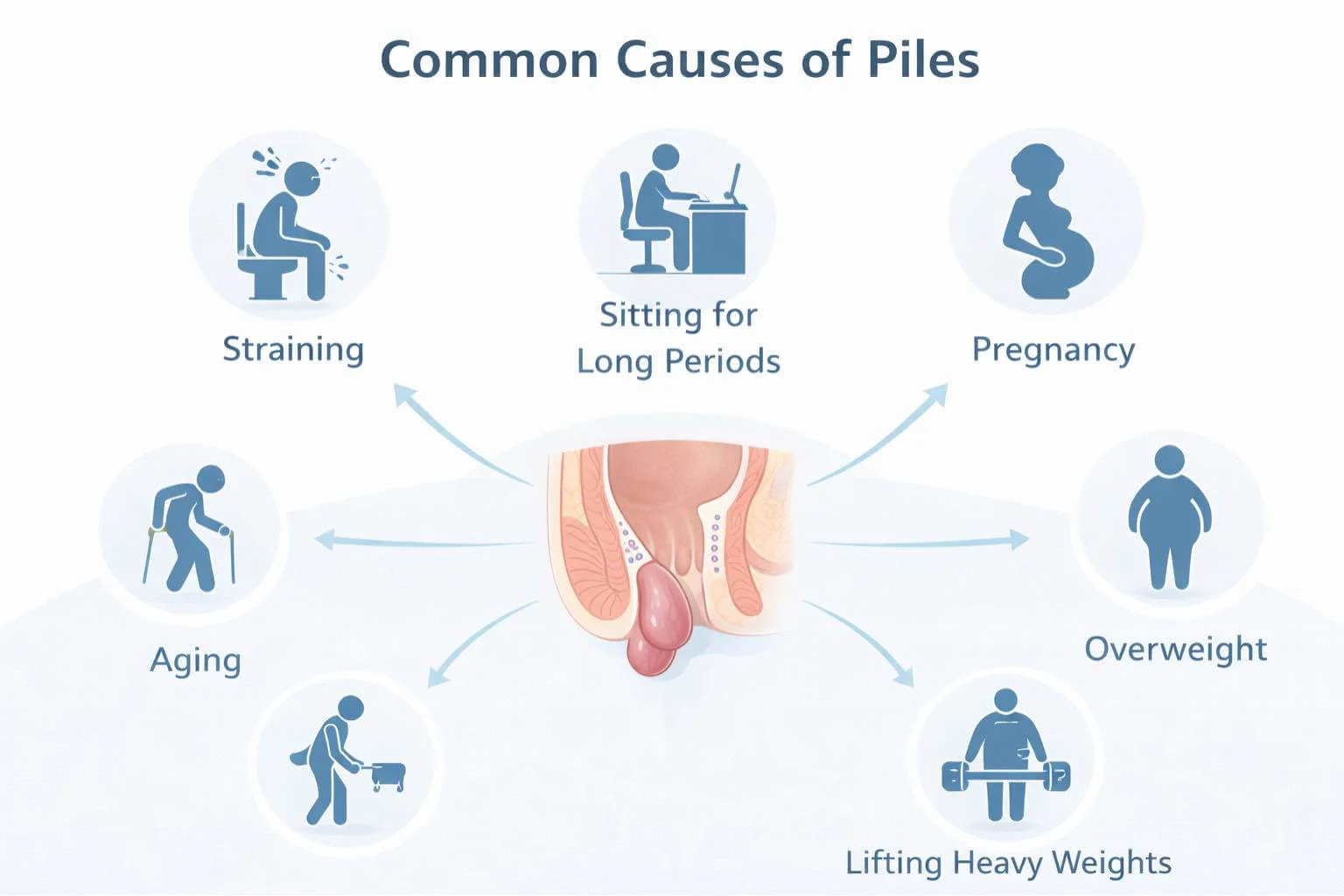 Causes of piles