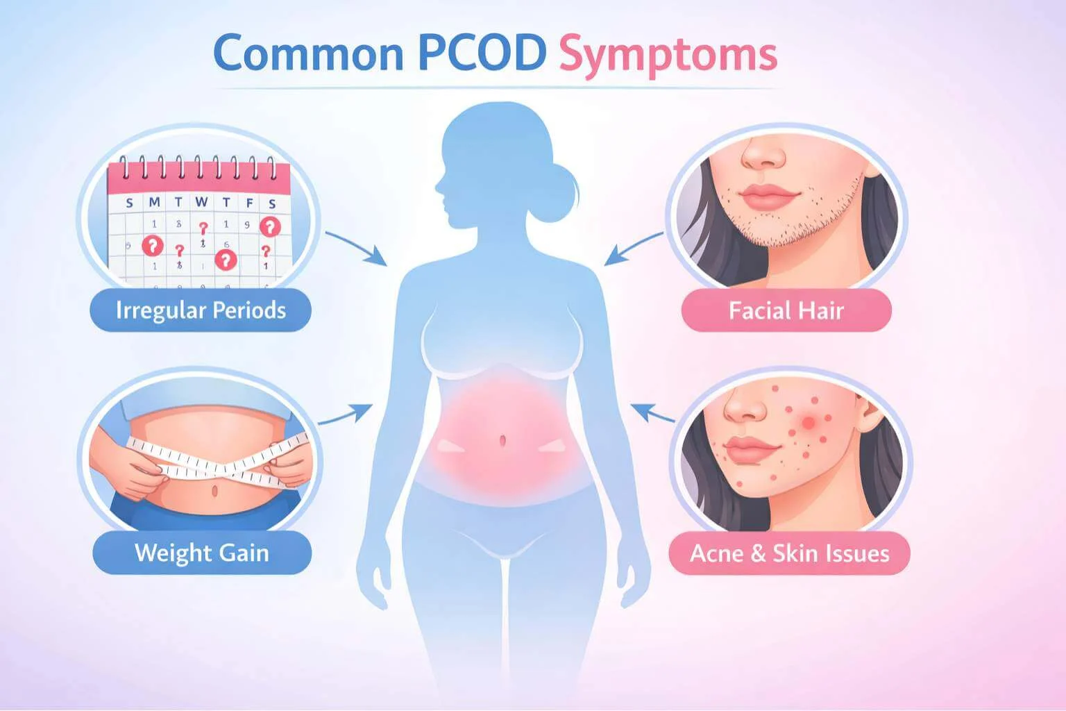 Common PCOD symptoms in women including irregular periods, weight gain, acne and hair growth