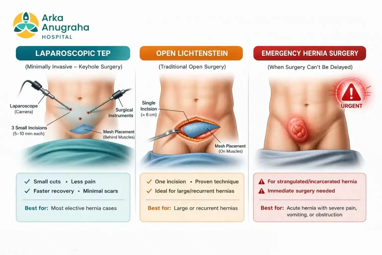 Infographic comparing laparoscopic vs open hernia surgery — incision size and recovery time